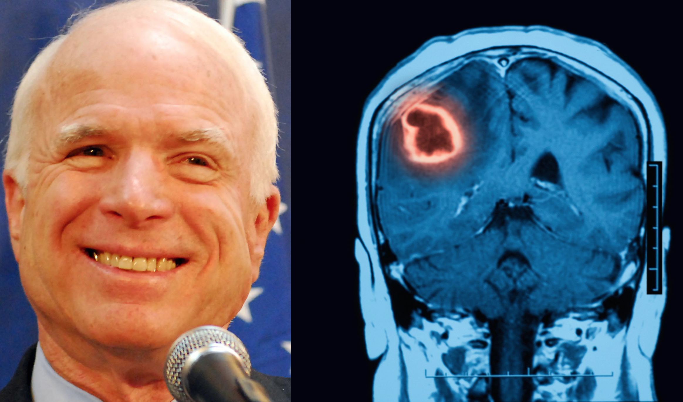 Millions of Americans send thank-you notes to John McCain's skull
